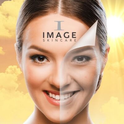 Image Sun Damage Repair