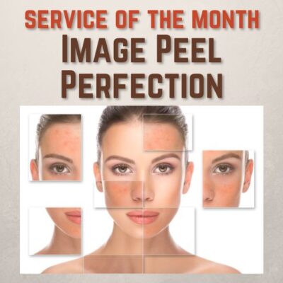 Image Peel Perfection